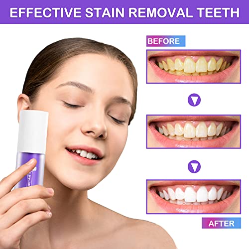 Purple Toothpaste For Teeth Whitening, Purple Whitening Toothpaste Extra Whitening, Purple Tooth Whitening Gel Stain Removal Toothpaste For Sensitivity Relief And Enamel Repair #TOP2