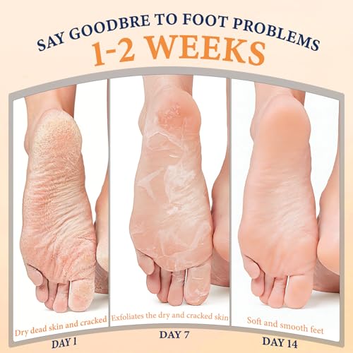 Z:SEA Foot Peeling Mask 5 Pack, Foot Mask for Dry, Cracked Feet, Exfoliator Peel Off Calluses Dead Skin, Repairs & Softens Rough Skin, Foot Spa Moisturizing Socks with Urea, Shea Butter, Jojoba oil - Image 5