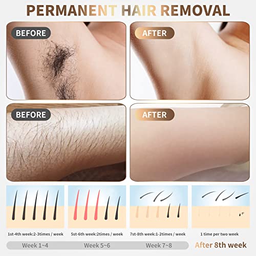 Image of IPL Laser Hair Removal Device for Women & Men - At-Home Painless Ultra-Fast Flash Hair Remover, 86% Hair Reduction in 4 Weeks, High Energy & 5 Modes, 8 Mins Full Body & Bikini Line & More, Corded