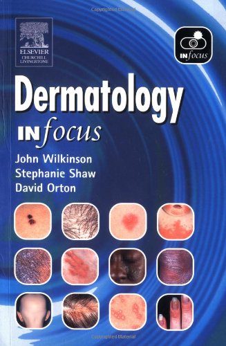 Churchill Livingstone Dermatology in Focus