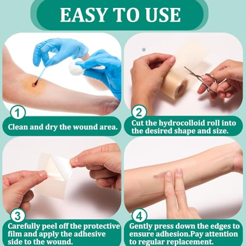 Image of Hydrocolloid Roll, Hydrocolloid Tape, 5 cmx150 cm Waterproof Skin Patch Tape, Cut-to-Size, Self-Adhesive Skinfriendly Hydrocolloid Tape Patches Pads