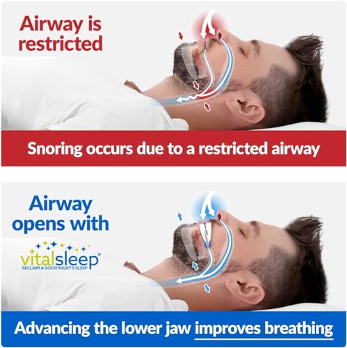 VitalSleep Anti-Snoring Mouthpiece, Comfortable & Adjustable Snore Guard, Quiets Snoring, USA Made, BPA Free & FDA Cleared Anti-Snore Device – Men’s Size