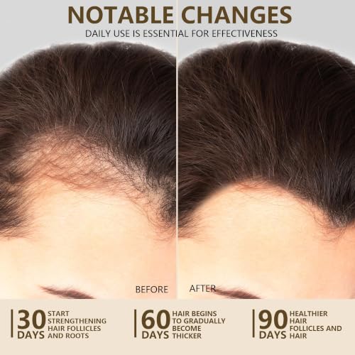 Image of 100% Natural Raw Batana Oil for Hair Growth, Unrefined & Organic Dr Sebi Hair Growth Oil From Honduras, Prevents Hair Loss, Eliminates Split Ends, Enhances Thickness 5.07 Fl Oz (Pack of 2)