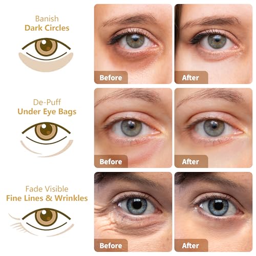 Under Eye Patches 30 Pairs Masks for Dark Circles Puffy Eyes - image 3