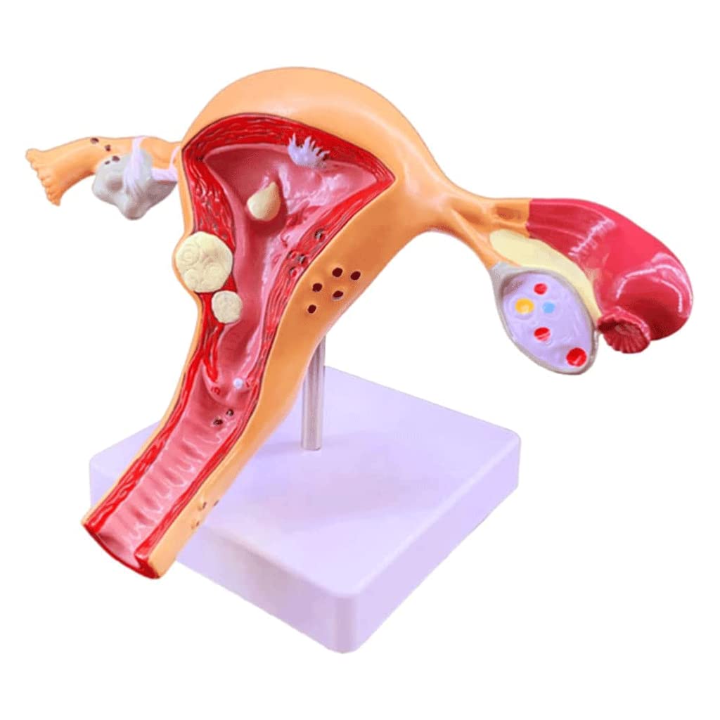 1、医療用 模型 子宮 解剖学的女性生殖器模型 木製ケース入り 送料込みで発送 Amazon.co.jp: 人体子宮模型, 子宮と卵巣の病理学的模型1:1