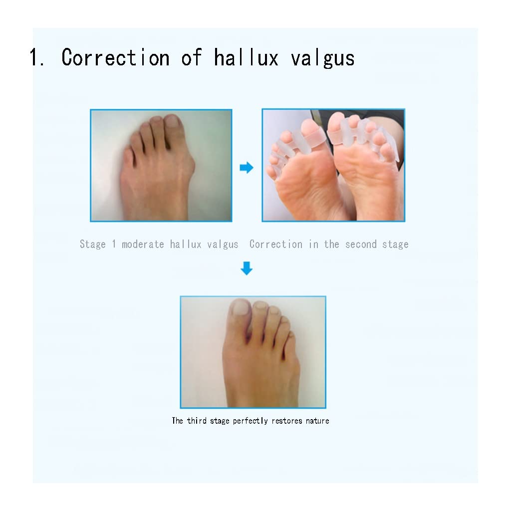 Separador de Dedos de Gel, estiradores de Dedos de Gel para Dedos superpuestos, fácil de Usar en Zapatos, Alivia rápidamente el Dolor después de Yoga y Actividades Deportivas