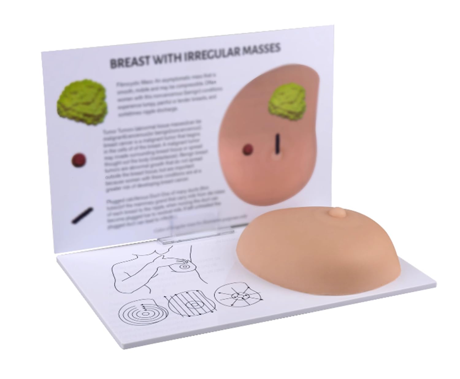 Modèle de cancer de poitrine en silicone pour examen de nodule mammaire