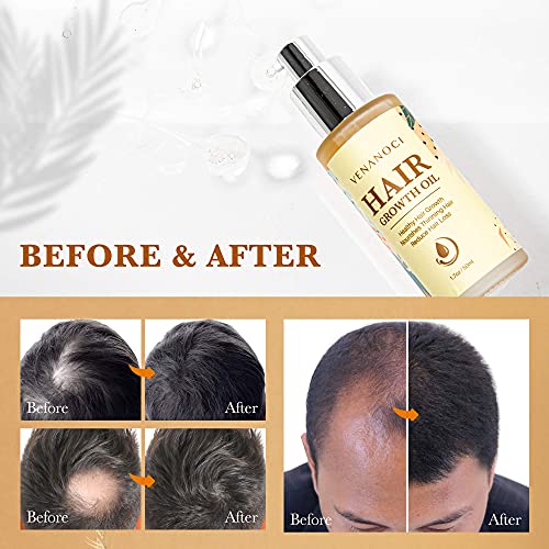 Venanoci Hair Growth Oil - Effective For Hair Growth, Hair Loss Liquid, Hair Growth Formula, Hair Care Serum, For Thicker & Healthier Hair, Reduces Hair Shedding & Thinning - Thumbnail 6