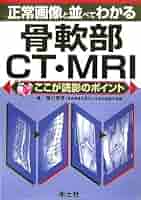 大系骨・関節の画像診断I II T.R.ヨーカム、 L.J.ロウ; 福田 国彦 大系骨・関節の画像診断I II | T.R.ヨーカム, L.J.ロウ, 福田