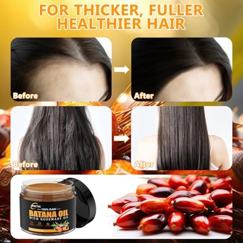 Raw Batana Oil for Hair Growth,Rosemary Oil,100% Natural Pure Dr. Sebi Batana Oil from Honduras,Unrefined Organic Batana Oil Hair Growth Oil for Prevent Hair Loss 5.3 oz