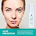 Acne Spot Treatment for Acne Prone Skin - Treats Cystic Acne, Advanced Acne Removal, Fast-Acting, Pimple Repair with Tea Tree Oil & Plant Extract, All Natural - 30g