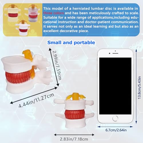 Image of Human Anatomical Lumbar Herniation Model with Nerve Root,Anatomical Vertebrae Model for Education,Excellent Way for Demonstrating Disc(Yellow)