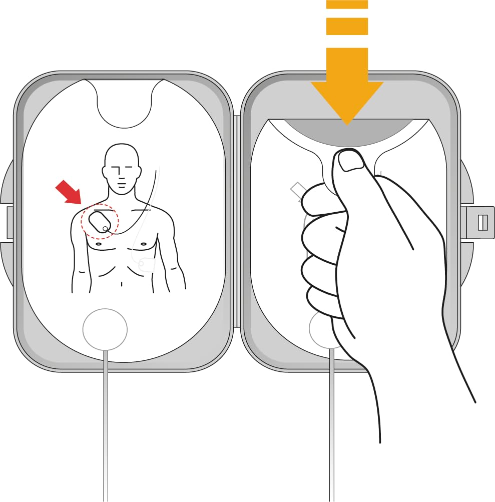 Desfibrilador Philips HeartStart FRx: Cartucho de electrodos SMART II
