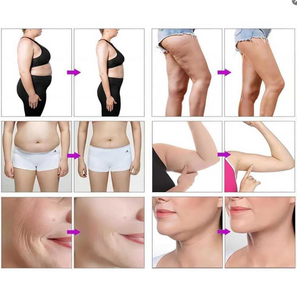 Congelamento dei Grassi Dimagrante Macchina, 360° Criolipolisi Macchina con 3 Maniglia, Massaggiatore per la Rimozione della Cellulite