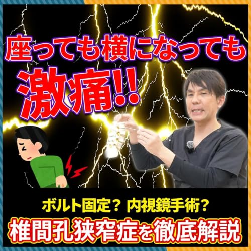 【椎間孔狭窄症】座っても横になっても痛い！その原因・症状・治療方法を徹底解説