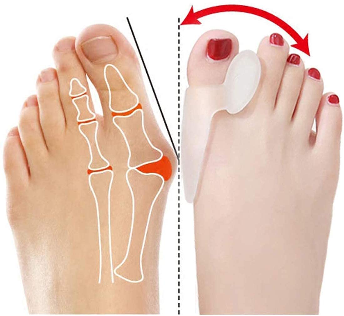 2 Paia di Separatori per Dita dei Piedi, correttori per Dita dei Piedi, Sollievo dall'alluce valgo, Gel di Silicone per Uomini e Donne, Cuscinetti in Gel per Un rapido so