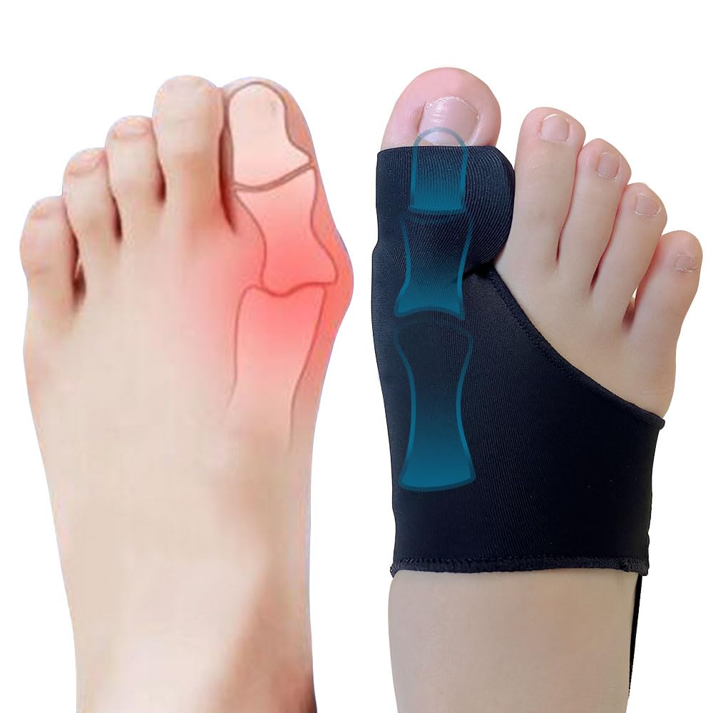 Qxotvzy Bunion Corrector for Women & Men Hallux Valgus Sleeves Splint With Toe Gel Spacer, Big Toe Straightener Treatment Protector Pads, Pain Relief Orthopedic Foot Care Day/Night