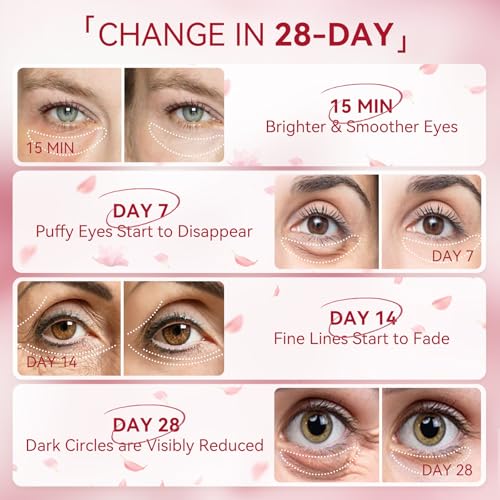 Under Eye Mask for Puffy Eyes & Dark Circles – BREYLEE Rose Eye Mask – 60 Pcs Eye Patches with Caffeine & Collagen – Reduce Wrinkles & Fine Lines – Best Undereye Patch Treatment - Image 7