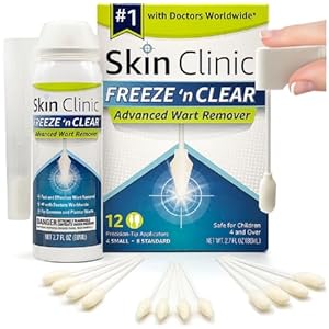 Skin Clinic FREEZE 'n CLEAR Fortschrittlicher Warzenentferner – 12 Applikatoren