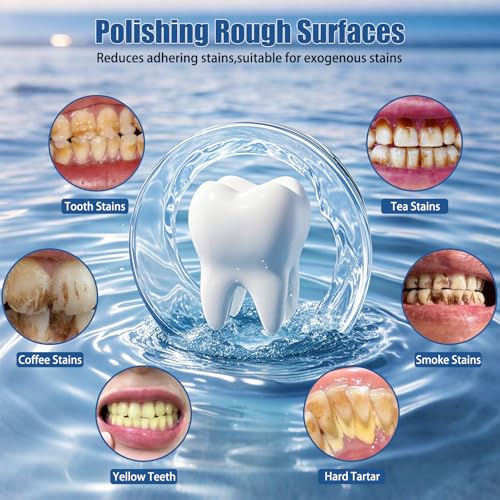 Zahnpolierer, Wiederaufladbare Zahnaufhellung Kit für Zahnreinigung und Aufhellung, Elektrischer Zahnpolierer mit 3-Zahnpolierpaste, 5-Bürstenköpfe, 5-Geschwindigkeitsmodi, LED-Licht – Bild 3