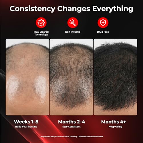 Image of CAYAMA Red Light Hair Growth Cap for Men & Women, 528 Total Light Emitters