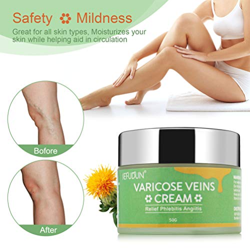 EXCEART Caixa 1 Varizes Alívio Creme Alívio Flebite Angiite Dor Pernas Creme
