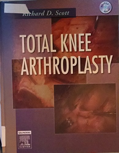 Total Knee Arthroplasty view 2