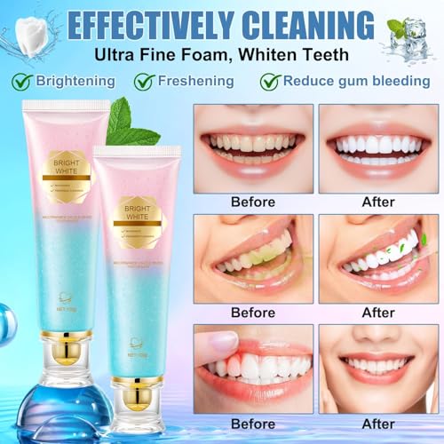 2 Pack Nicotinamid Whitening Zahnpasta – Niacinamid-Zahnpasta 100g für weiße Zähne, Zahnschmelzpflege, Tiefenreinigung & frischen Atem, ohne Fluorid (A) – Bild 3