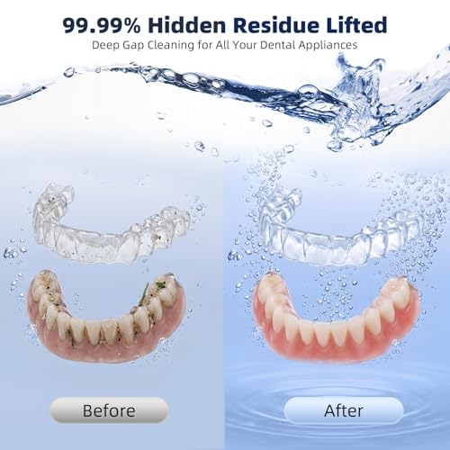 Image of Ultrasonic Retainer Cleaner Machine for Dentures Aligners Mouth Guards | 45kHz Ultrasonic Cleaning, 200ML Tank, Dual Modes for Night Guards Braces Toothbrush Heads Jewelry Dental Appliances