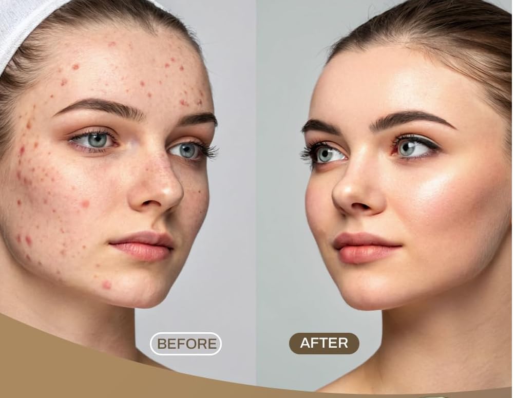 Nac Natural's Multani Mitti Powder for face Oily, Acne-Prone Skin | multani mitti for face Oil Control & Pimple Care | Fuller’s Earth Clay | de tan pack face pack 100g 1