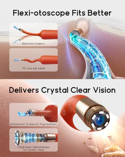 Image of Bebird D39R Ear Wax Removal:Ear Camera with Storage Case &Painless Tweezers
