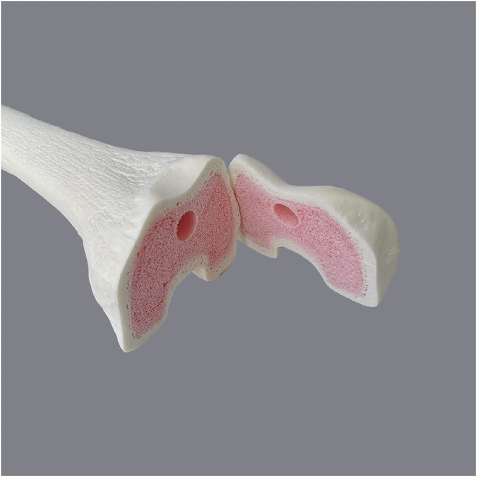 Amazon.co.jp: シミュレーション大腿骨モデル - 大腿骨整形外科