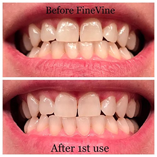 100% Natural Charcoal Teeth Whitening Toothpaste| Charcoal ...