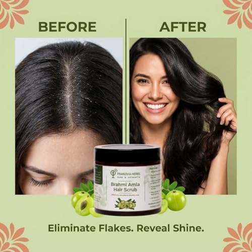 Image of Hair & Scalp Scrub for Dandruff & Build-Up | Anti-Dandruff Exfoliator | Brahmi Amla Pink Himalayan Salt Moringa | Sulfate & Paraben Free