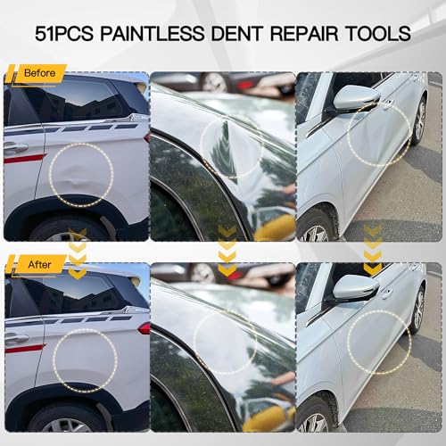 Image of 51PCS Dent Puller Kit,Paintless Dent Removal Kit with Slide Hammer T-Bar,Bridge Puller,Glue Gun,Golden Lifter,Suction Cup,Car Dent Repair Tool for Auto Body Dents, Hail Damage,Refrigerator Door Ding