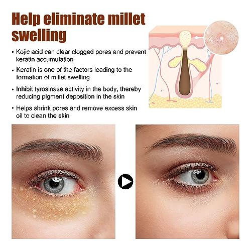 Milia Removal Eye Creams,Milia Spots Removal Eye Cream,Milia Remover,Firming Anti Wrinkle Whitening Eye Cream,Smooth Milia Eyes Cream,Milia Spot Care Cream,15g - Image 6