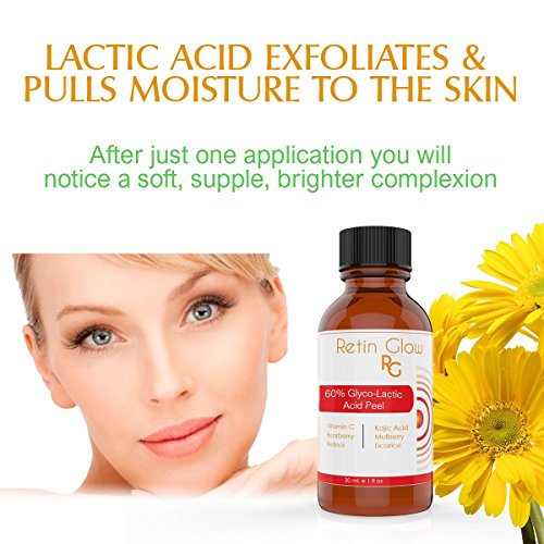 Lactic Acid 80% Gel Peel Including After Peel Neutralizer Facial Peel Contains Retinol Vitamin C Kojic Acid Licorice Bearberry Tea Mulberry. Perfect Acne Treatment Fade Acne Scars Diminish Wrinkles - Thumbnail 2
