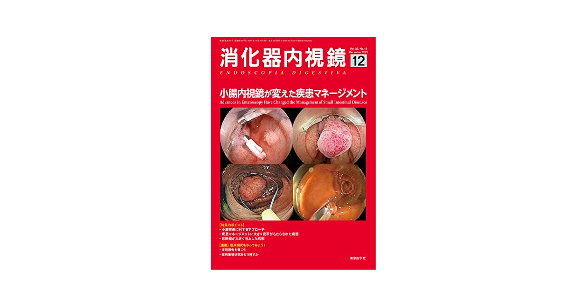 消化器内視鏡33巻2021年増刊号 消化管内視鏡治療-基本から高難度まで 「消化器内視鏡」編集委員会 51WFQXGGD3L._AC_SY200_QL15_.jpg