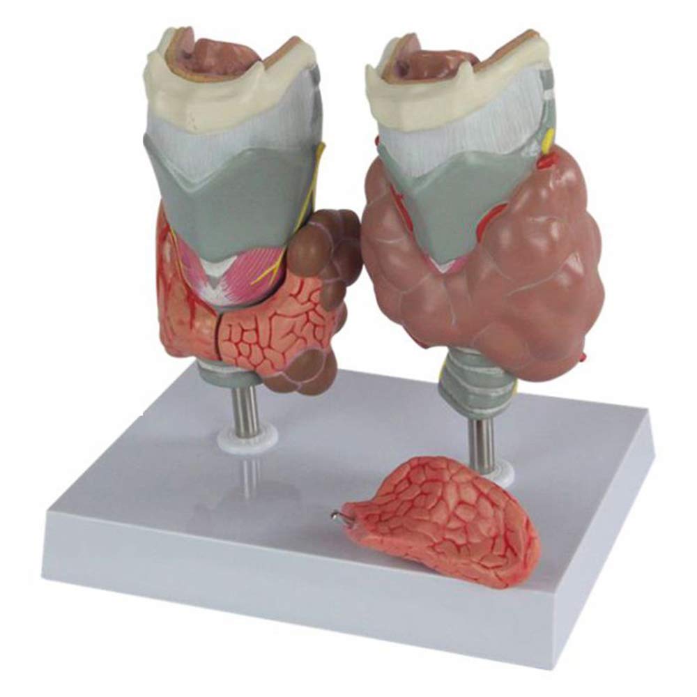 Sjdopulse Thyroid Model - Human Organ Anatomy Model Thyroid Diseased Pathology Model - Educational Human Thyroid Pathology Anatomical Model - For Science Classroom Teaching Medical Model,A