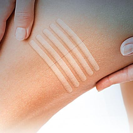 Miniatura 8 de Eurosuture - Cierre de piel 15 x 1 12 pulgadas - Tiras de sutura estériles, adherencia dinámica y seguridad superior - 2 sobres de 6 tiras cada una