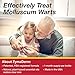 ZYMADERM Molluscum Contagiosum Treatment for Kids and Adults - Fast Acting, Discomfort-Free Reducer w/Applicator
