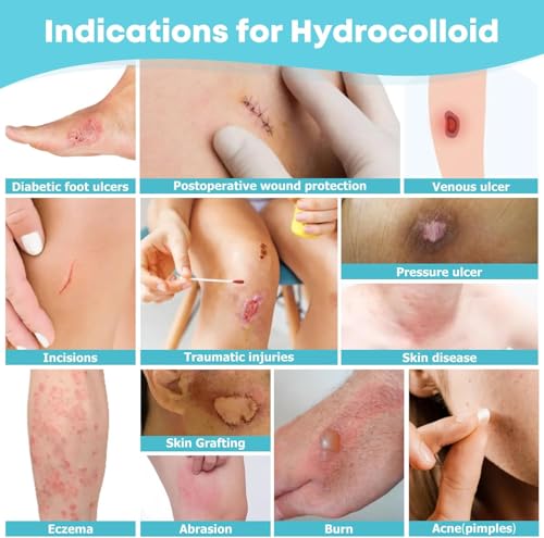Image of Hydrocolloid Roll for Wound Care HSA FSA Eligible, 2in*12ft, 19.7mil / 0.5mm Thickness, Medical Grade