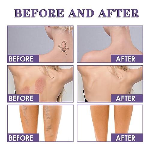 KUIRUNRX® Tattoo cover-up make-up, tattoo-afdekking, make-up, been-make-up, waterdicht, bodymake-up, foundation, waterdicht, voor arm, benen, littekens, 74 ml - Afbeelding 4
