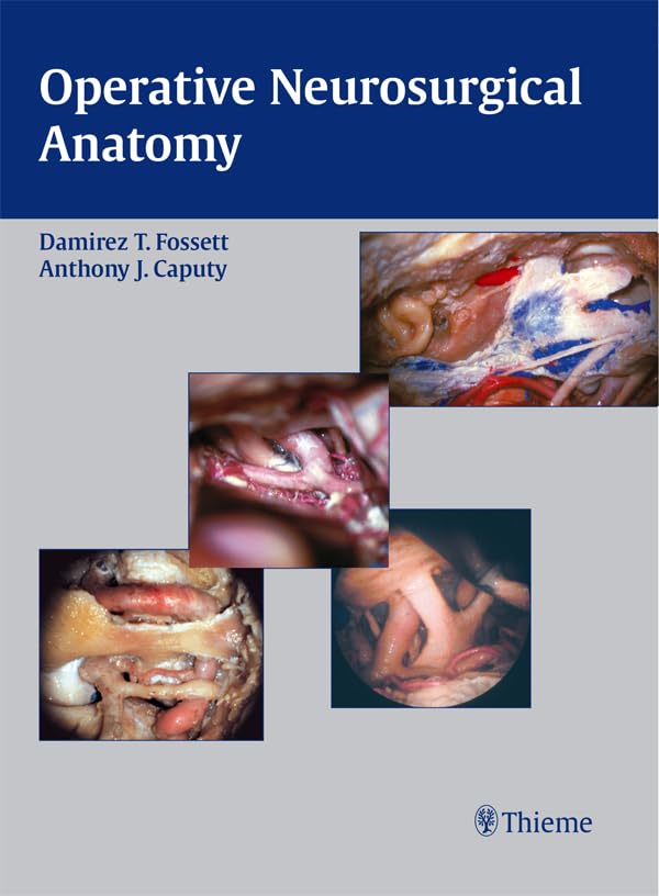 Operative Neurosurgical Anatomy      1st Edition, Kindle Edition