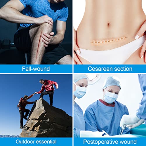 Large Butterfly Bandaids, Steri Strips Wound Closure, Emergency Wound Closure Device Surgical Laceration Repair Without Stitches For Extra Large Wound Care, Ahead Be Prepared (Pu) #TOP4