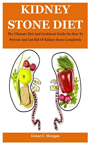 Kidney Stone Diet: The Ultimate Diet And Cookbook Guide On How To Prevent And Get Rid Of Kidney Stone Completely Kidney Stone Diet: The Ultimate Diet And Cookbook Guide On How To Prevent And Get Rid Of Kidney Stone Completely