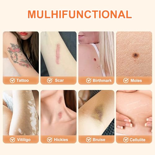 MlanRomee 8 PCS Invisible Tattoo Cover Up Patch, Waterproof & Breathable Concealer for Tattoos, Scars, Birthmarks - Darker Skin Tone - Thumbnail 6
