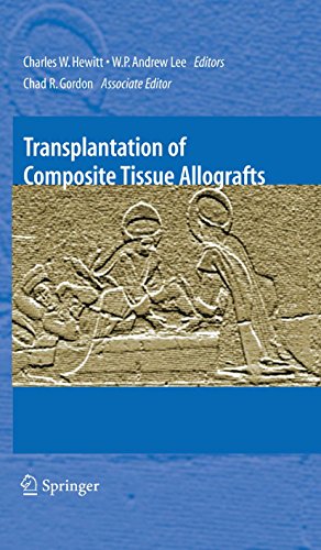Transplantation of Composite Tissue Allografts Transplantation of Composite Tissue Allografts