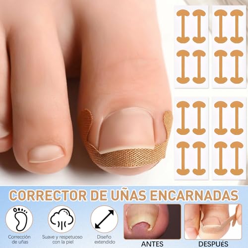 Opiniones y reviews de Desenterrador de uñas Top 5. 5 Imagen adicional