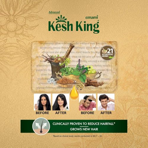 Kesh King Ayurvedic Hair Oil | Herbal Oil with Bhringraj & Amla | Enhance Hair Growth | Reduce Hairfall | Nourishes Scalp | Provides Long & Thick Hair | 1.69 Fl Oz/50ml